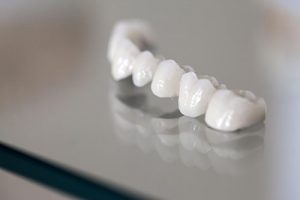 Dental Crowns and Bridges | Dentist Glenroy