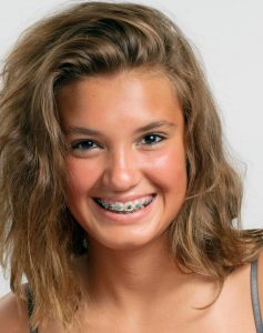 all-about-braces-glenroy-dentist