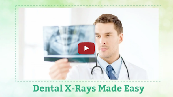 Modern Dental X-rays: Fast, Reliable and Efficient