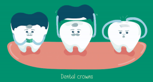 All About Dental Crowns