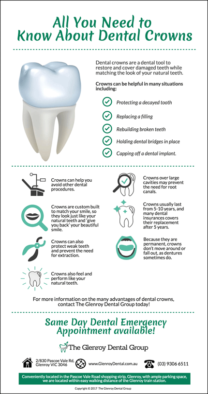 All About Dental Crowns