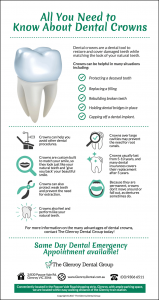All About Dental Crowns