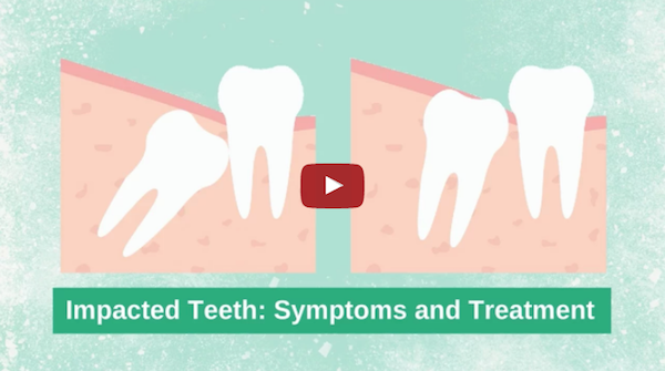 Warning Signs of Impacted Teeth