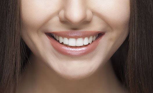 Tooth Bonding – Your Quick Path To A Better Smile