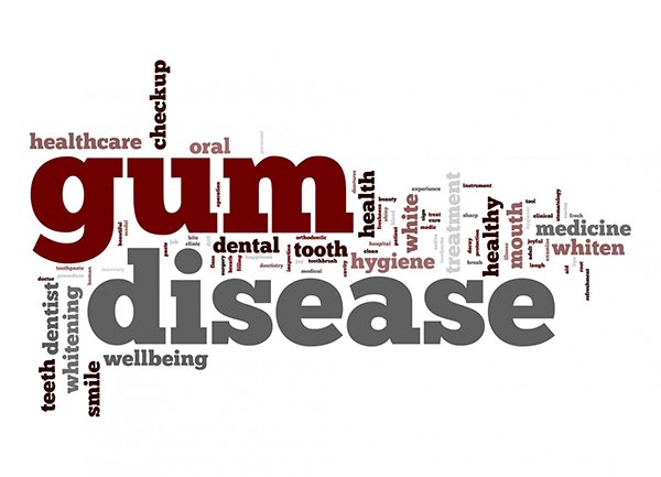 Gum Disease –Treatment And Prevention