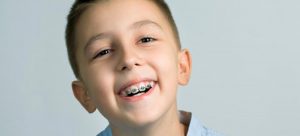 Why It Is Important For Your Child To Get Braces