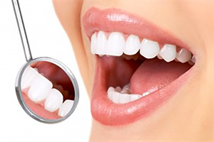 How much veneers cost in Glenroy | The Glenroy Dental Group