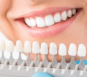 The Most Popular Cosmetic Dentistry Procedures- Dentist Glenroy