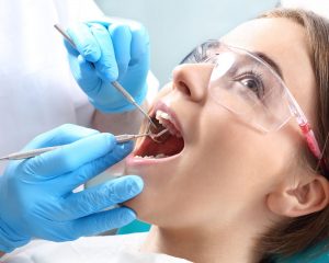 Tips to Look After Your Dental Implants